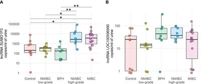 The long noncoding RNA SUMO1P3 as urinary biomarker for monitoring bladder cancer progression